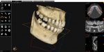 Tac-Dental-3D-MDI