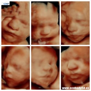 Ecografía 5D Ecobody